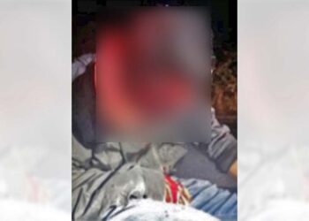 Resultó con diferentes lesiones y fue llevado a un hospital.