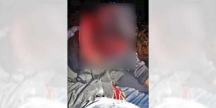 Resultó con diferentes lesiones y fue llevado a un hospital.