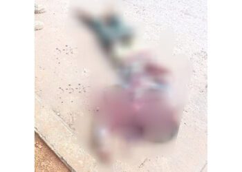 Sangriento ataque a machetazos en pleno día en Santa María Petapa