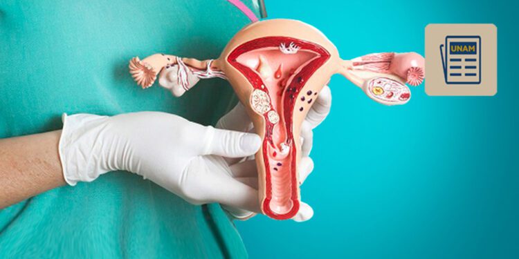 Cáncer de ovario; aumentan muertes 34%, ¿Cuáles son los síntomas?