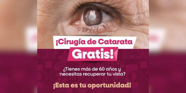 ¿Sabías que puedes recuperar la vista con una cirugía gratuita en México si tienes cataratas?