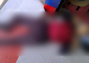 El adulto mayor sufrió un infarto agudo al miocardio.