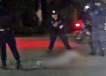 Resultó con lesiones en el rostro tras caerse frente a un módulo de policía.