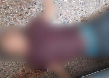Un joven resultó con diferentes lesiones luego de haber sido atropellado.
