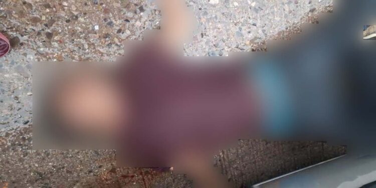 Un joven resultó con diferentes lesiones luego de haber sido atropellado.