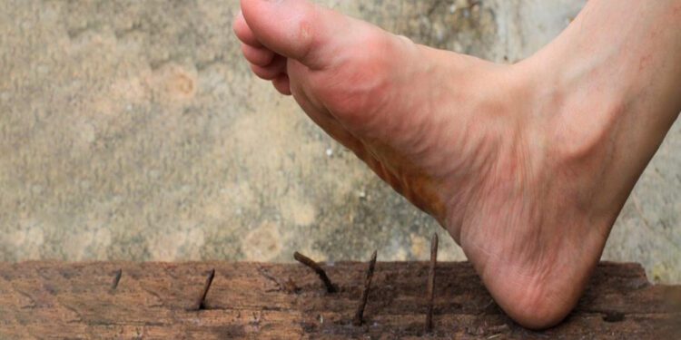 Te enterraste un clavo: ¿Tétanos? Qué hacer paso a paso para evitar complicaciones