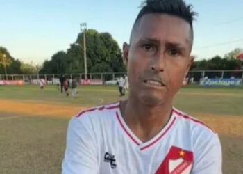 El ex jugador del América, Osvaldo Martínez dio detalles de la esclerodermia. Foto: Internet