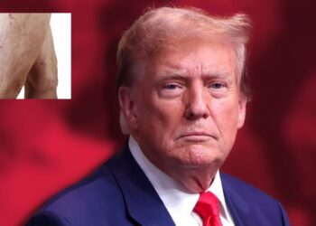 Casa Blanca confirma problema circulatorio en Trump: ¿qué tan grave es?