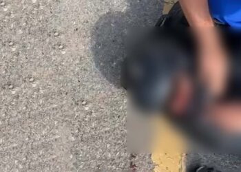 El joven motociclista tuvo varias lesiones de consideración.