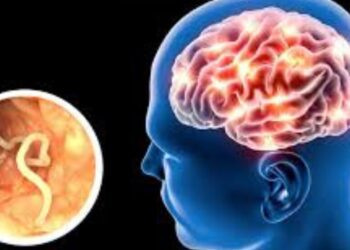 ¿Picor en la ‘colita’? Podría ser señal de un parásito mortal: Neurocisticercosis