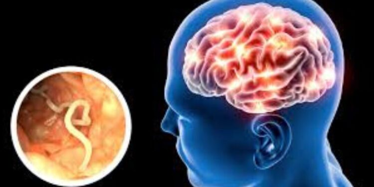 ¿Picor en la ‘colita’? Podría ser señal de un parásito mortal: Neurocisticercosis