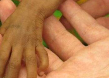 ¡Muere bebé rescatada por maltrato! Padecía desnutrición, cardiopatía y abandono familiar