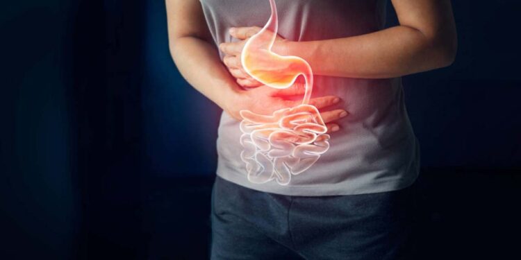Foto: ilustrativa // La contaminación de alimentos puede provocar enfermedades gastrointestinales como infecciones por Salmonella, E. coli y Shigella y más.