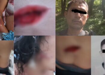 ¡Atroz intento de feminicidio en Sierra Sur! Mujer sobrevive a brutal ataque con machete por parte de su ex pareja