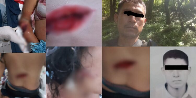 ¡Atroz intento de feminicidio en Sierra Sur! Mujer sobrevive a brutal ataque con machete por parte de su ex pareja
