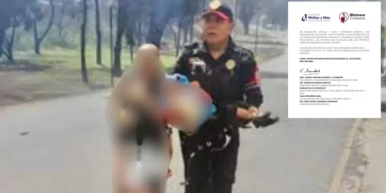 Jazlyn Azulet, la menor de Iztapalapa, recibe tratamiento de alta especialidad en EE.UU. gracias a la solidaridad mexicana