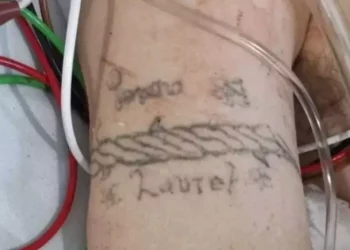 ¿Quién es la joven quemada en Iztapalapa? Misterio sin resolver tras explosión de pipa de gas