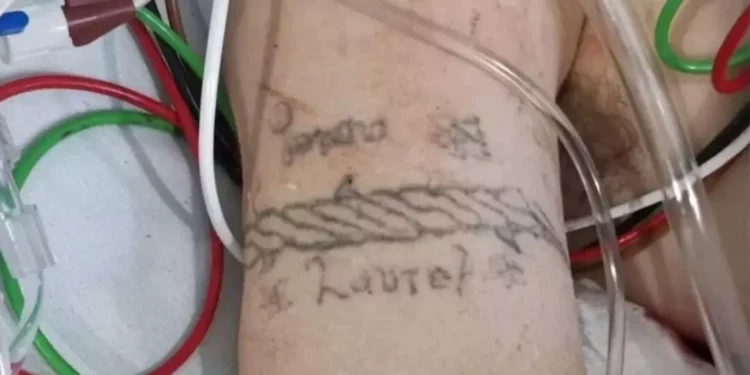 ¿Quién es la joven quemada en Iztapalapa? Misterio sin resolver tras explosión de pipa de gas