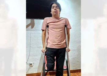 Emiliano Hernández, víctima de un accidente vial, exige justicia y apoyo para una prótesis tras perder una pierna. Foto: Cortesía