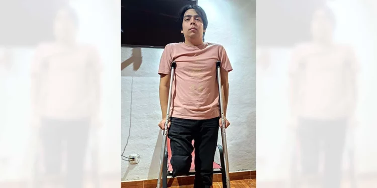 Emiliano Hernández, víctima de un accidente vial, exige justicia y apoyo para una prótesis tras perder una pierna. Foto: Cortesía