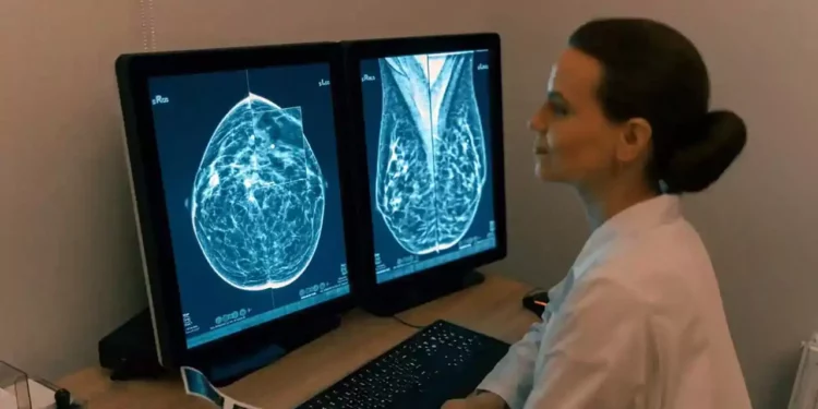 Foto: Archivo El Imparcial // Octubre, mes de sensibilización contra el cáncer de mama.