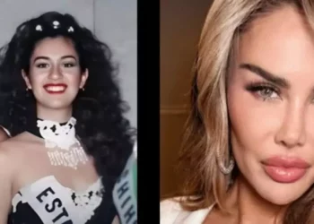 ¿Cuánto cuesta cambiarte el color de ojos como Ninel Conde?