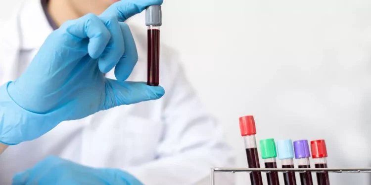 ¿Qué tipo de sangre vive más? La ciencia por fin tiene una respuesta