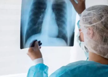 Foto: ilustrativa // La Secretaría de Salud federal asegura que, en el país, “el 80% de los pacientes con cáncer de pulmón tienen antecedentes de consumo crónico de tabaco.