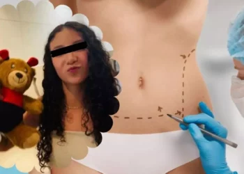 Ley Nicole: la reforma que protege a los menores de las cirugías estéticas