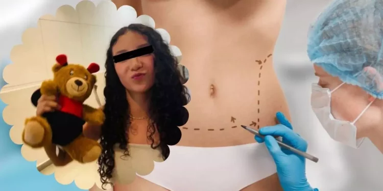Ley Nicole: la reforma que protege a los menores de las cirugías estéticas
