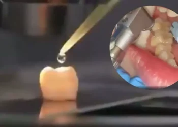 China en modo 2050: crean líquido regenerador de dientes