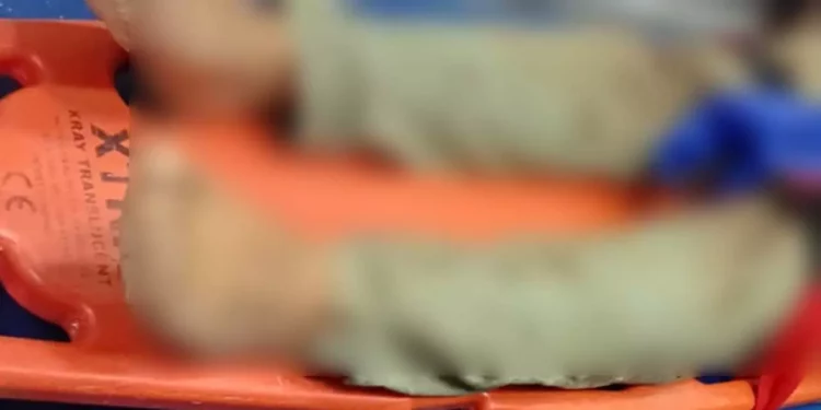 La víctima es un masculino no identificado, de aproximadamente 35 años de edad.