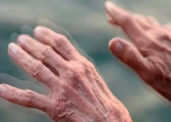 Foto: ilustrativa // La OMS explica que esta enfermedad suele afectar a personas mayores, pero también puede darse en las más jóvenes, “y suele afectar más a hombres que a mujeres”.