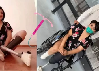 Vanessa acudió a retirarse el DIU en el IMSS y terminó con sus piernas amputadas