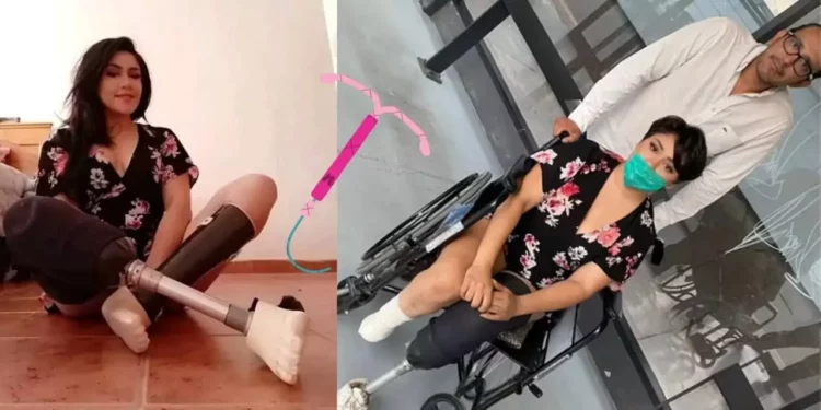 Vanessa acudió a retirarse el DIU en el IMSS y terminó con sus piernas amputadas