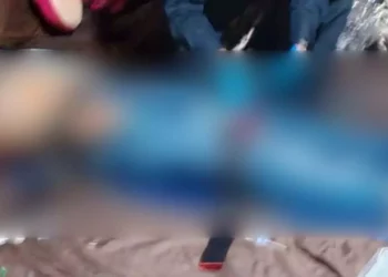 El hombre de 38 años de edad, presentaba una lesión por disparo de arma de fuego, a la altura de las costillas.