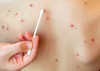 Foto: internet // Cualquier persona entre 6 meses y 49 años que no esté segura de haber recibido su dosis o que no tenga el esquema completo debe acudir a vacunarse.
