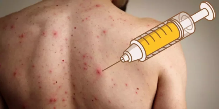 Foto: internet - ilustrativa // Si desconoces tu estatus vacunal, la recomendación oficial es acudir a tu unidad de salud más cercana.