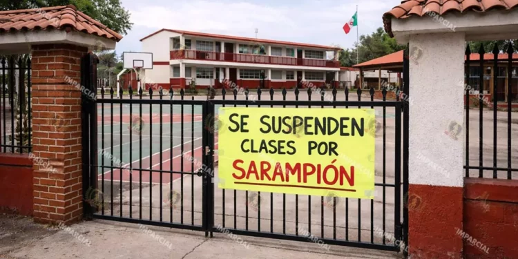 Foto: AI - Suspensión de clases en Jalisco y Aguascalientes ante brote de sarampión; vacunación y medidas preventivas son clave para frenar contagios.
