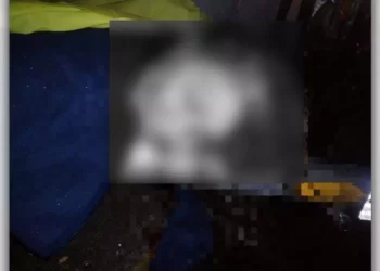 Pese a la rápida intervención de los cuerpos de rescate, la víctima no sobrevivió al traslado.