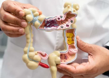 Foto: internet – ilustrativa // Cáncer de colon; 36 nuevos casos.