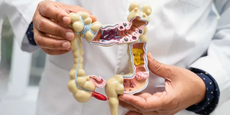 Foto: internet – ilustrativa // Cáncer de colon; 36 nuevos casos.