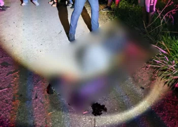 El motociclista sufrió una fractura expuesta; fue trasladado en código rojo.