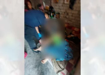 Paramédicos de Bomberos estabilizaron y trasladaron al hospital al lesionado.