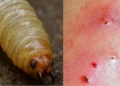 Gusano Barrenador en humanos: Síntomas, cómo se infecta y prevención