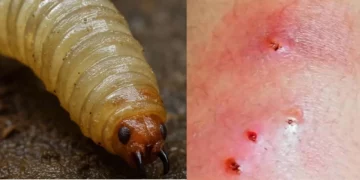 Gusano Barrenador en humanos: Síntomas, cómo se infecta y prevención