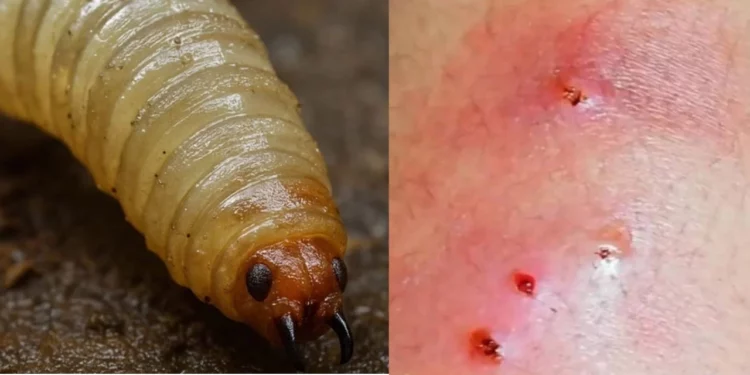 Gusano Barrenador en humanos: Síntomas, cómo se infecta y prevención