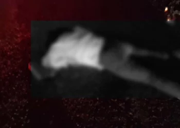 Conductora en estado inconveniente terminó con múltiples heridas superficiales.
