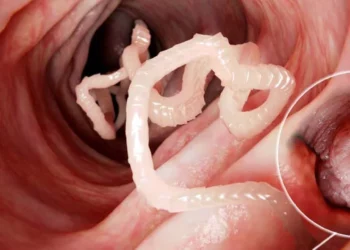 Las medidas para evitar las teniasis es evitar comer carne cruda o mal cocida