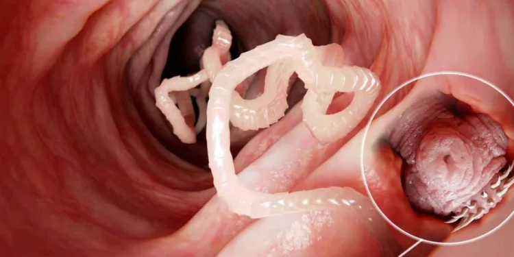 Las medidas para evitar las teniasis es evitar comer carne cruda o mal cocida